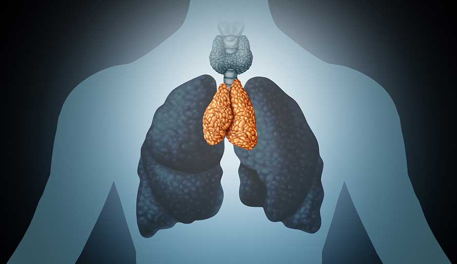 Thymoma Treatment in Hyderabad